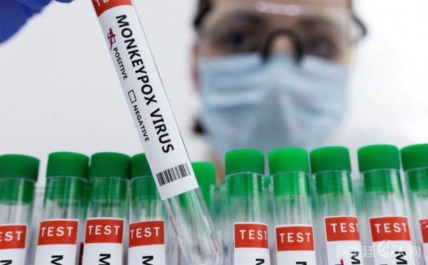 Confirman tres nuevos casos de la viruela del mono en Argentina