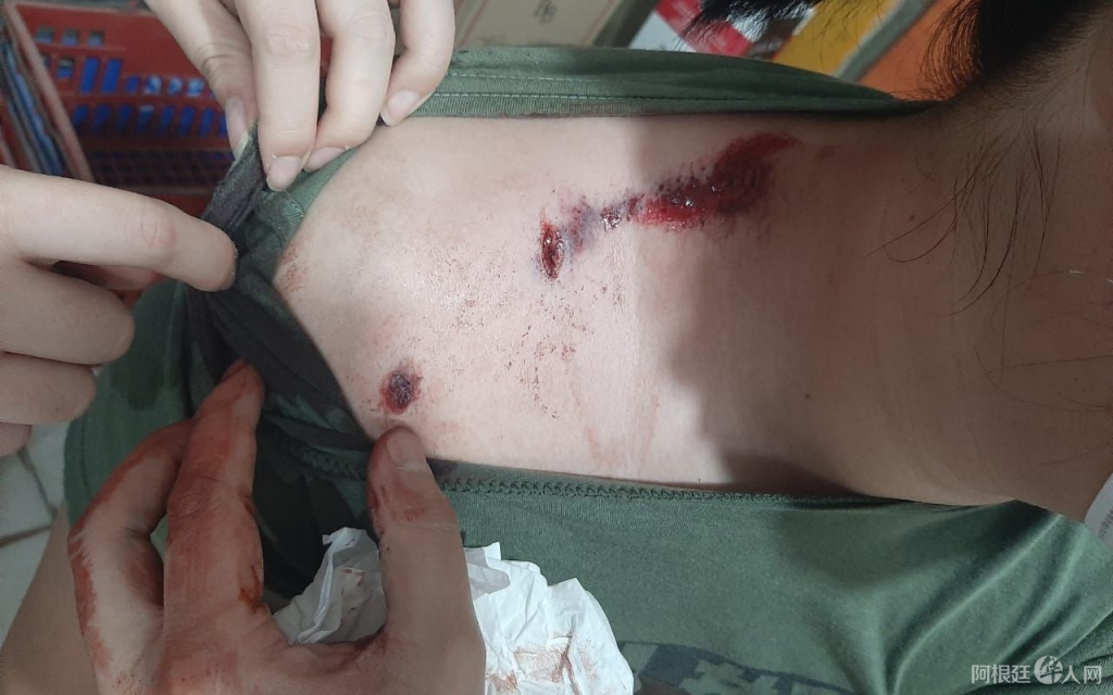 516ddef5-2053-4822-8252-42fa040d72df 516ddef5-2053-4822-8252-42fa040d72df